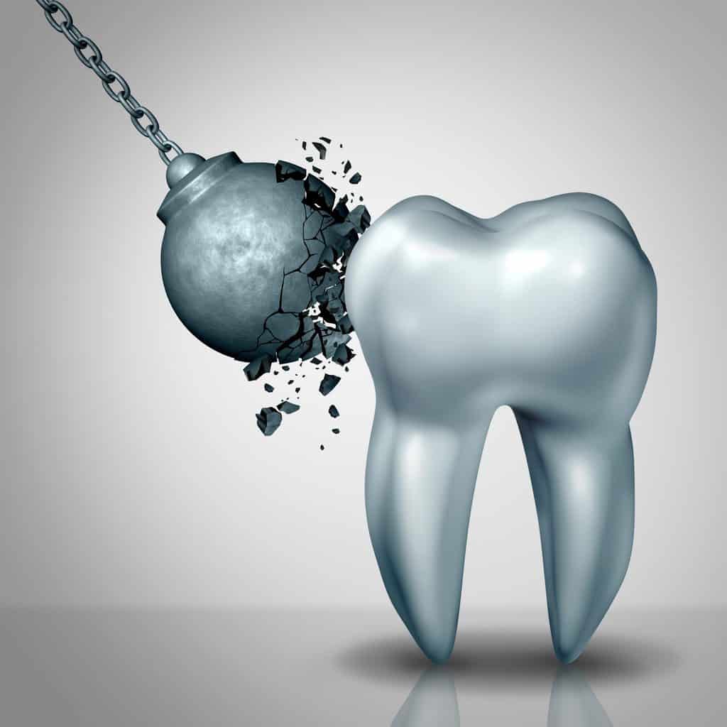 enamel erosion