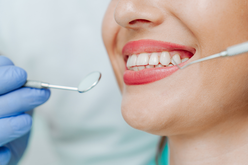 Dental Check-up and Clean Sutherland