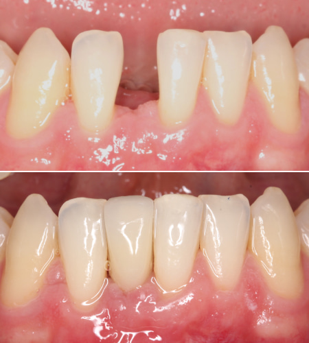 MK Before-After IMG