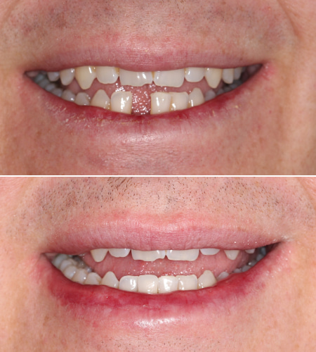 MK Smile Before-After IMG