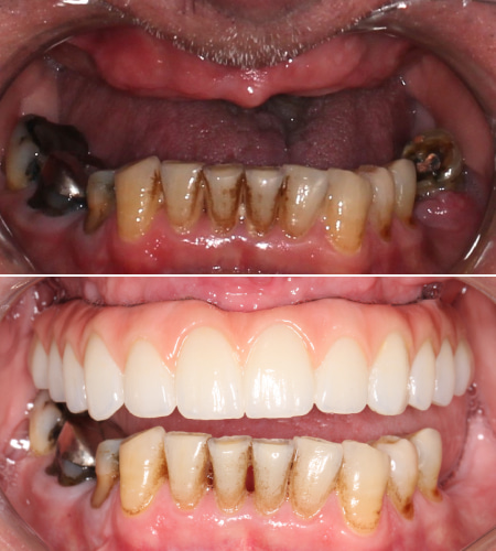 PS - Before - After - IMG