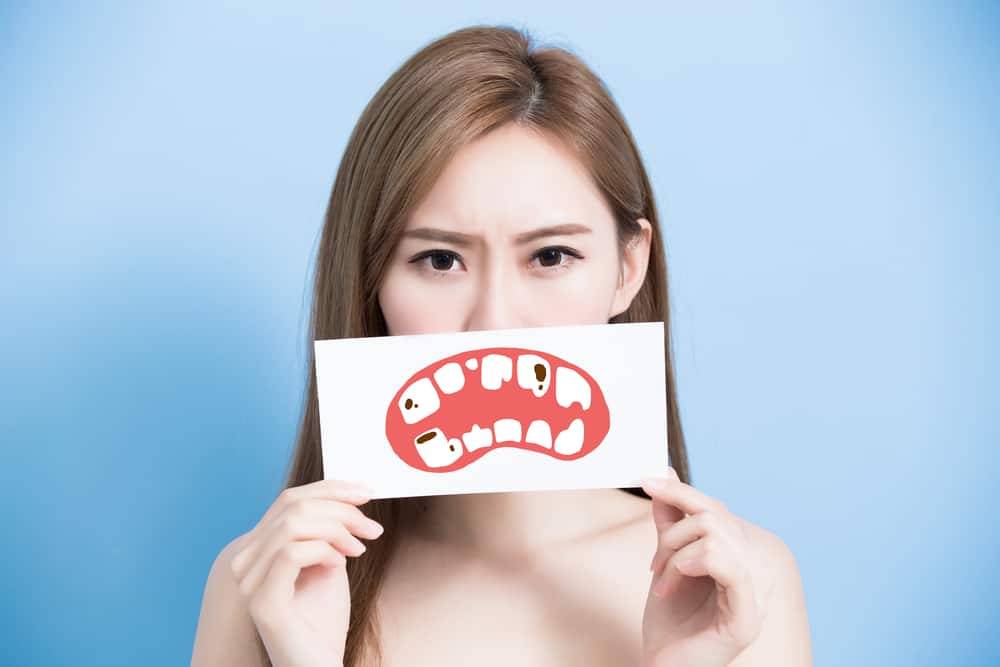 Image-of-poor-oral-health